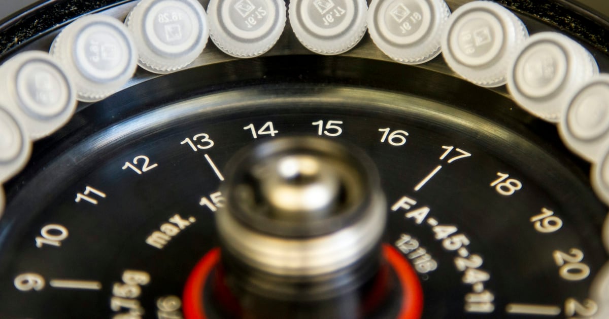 Close-up of a laboratory centrifuge rotor with a numbered speed dial